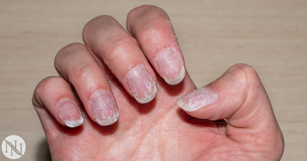 Natural-Nail-Care-Remedies