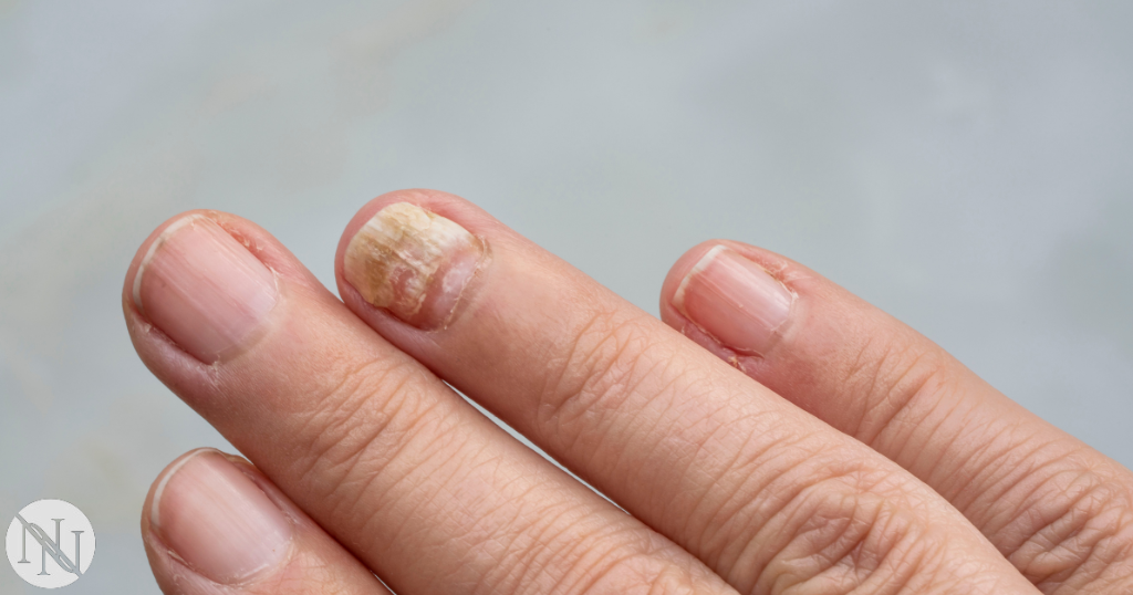 Nail Care Mistakes